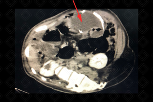 Texto alternativo para a imagem