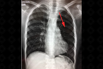 Texto alternativo para a imagem