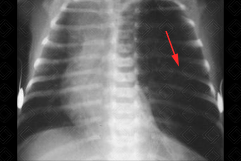 Texto alternativo para a imagem