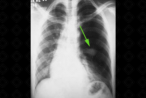 Texto alternativo para a imagem