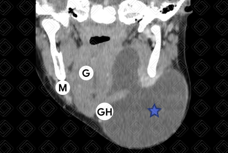 Texto alternativo para a imagem