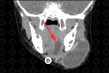 Texto alternativo para a imagem