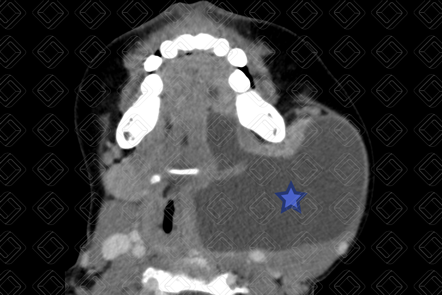 Texto alternativo para a imagem