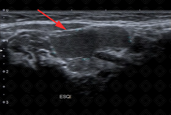 Texto alternativo para a imagem