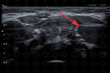 Texto alternativo para a imagem