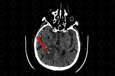 Texto alternativo para a imagem
