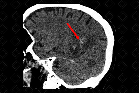 Texto alternativo para a imagem