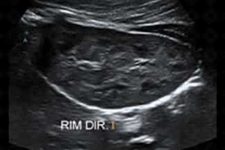 Texto alternativo para a imagem