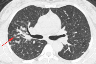 Texto alternativo para a imagem