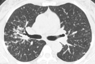 Texto alternativo para a imagem