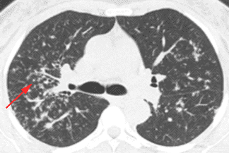 Texto alternativo para a imagem