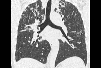 Texto alternativo para a imagem