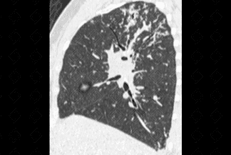 Texto alternativo para a imagem