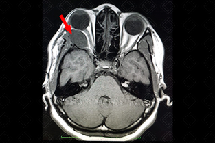 Texto alternativo para a imagem