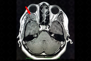 Texto alternativo para a imagem