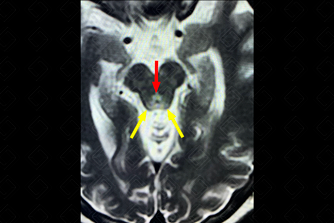 Texto alternativo para a imagem