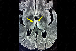 Texto alternativo para a imagem