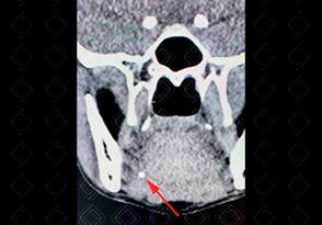 Texto alternativo para a imagem