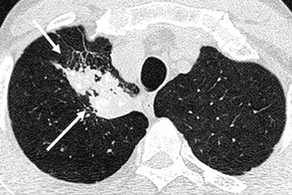 Texto alternativo para a imagem