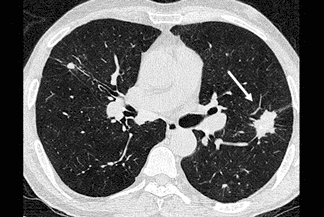 Texto alternativo para a imagem