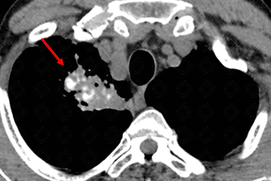 Texto alternativo para a imagem