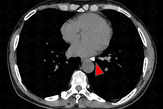 Texto alternativo para a imagem