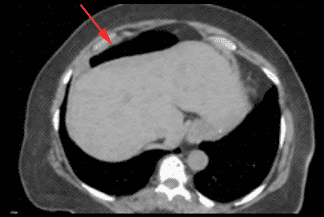 Texto alternativo para a imagem