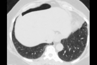 Texto alternativo para a imagem