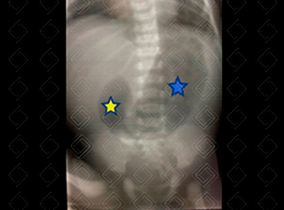 Texto alternativo para a imagem