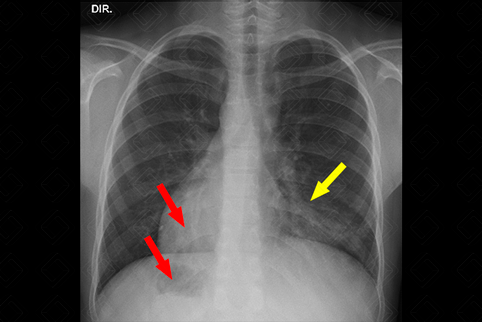 Texto alternativo para a imagem