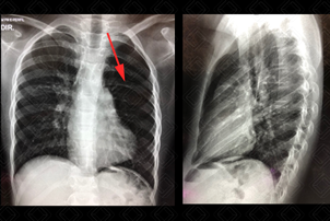 Texto alternativo para a imagem