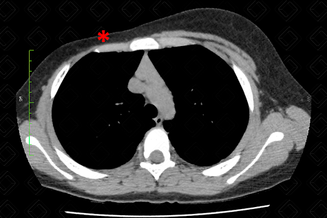 Texto alternativo para a imagem