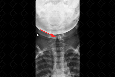 Texto alternativo para a imagem