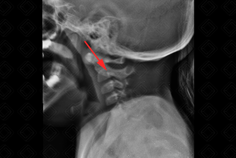 Texto alternativo para a imagem