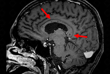 Texto alternativo para a imagem