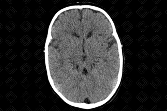 Texto alternativo para a imagem