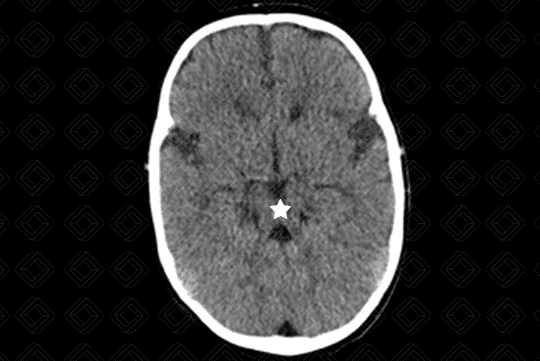 Texto alternativo para a imagem