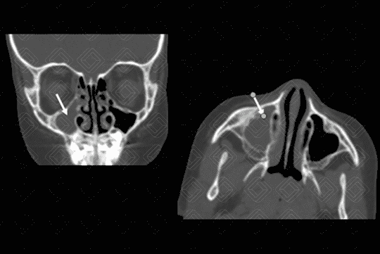 Texto alternativo para a imagem
