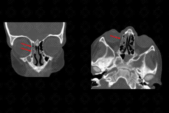 Texto alternativo para a imagem