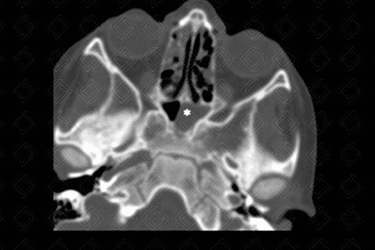 Texto alternativo para a imagem