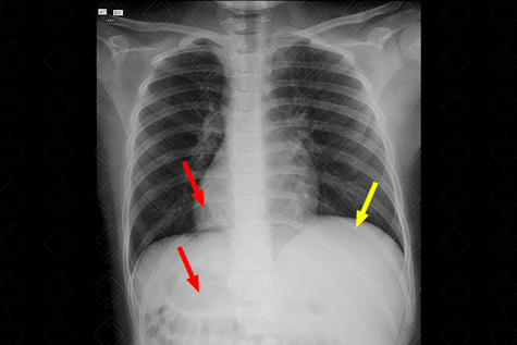 Texto alternativo para a imagem