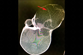 Texto alternativo para a imagem