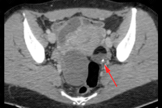 Texto alternativo para a imagem