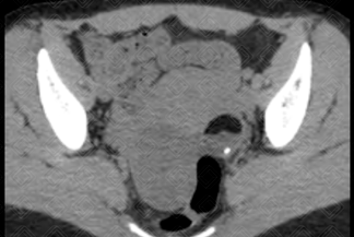 Texto alternativo para a imagem