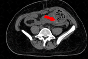 Texto alternativo para a imagem