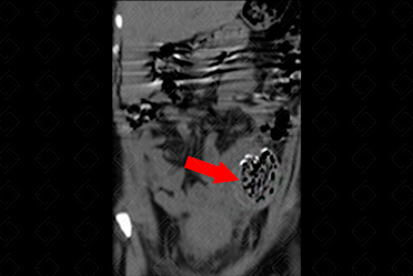 Texto alternativo para a imagem