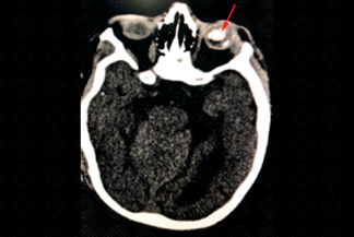 Texto alternativo para a imagem