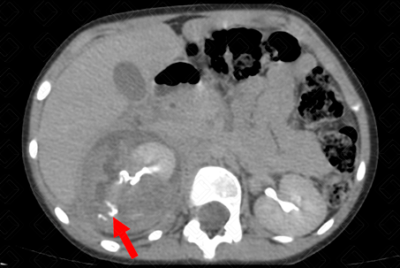 Texto alternativo para a imagem