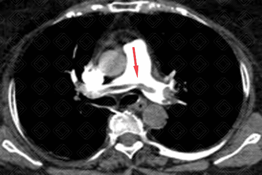 Texto alternativo para a imagem