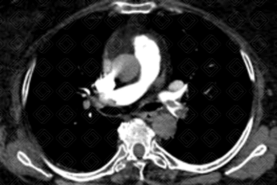 Texto alternativo para a imagem